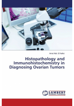 Histopathology and Immunohistochemistry in Diagnosing Ovarian Tumors