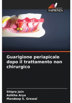 Guarigione periapicale dopo il trattamento non chirurgico