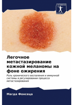 Легочное метастазирование кожной меланомы на фоне ожирения