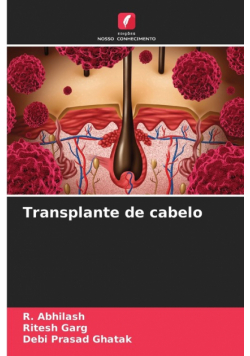 Transplante de cabelo
