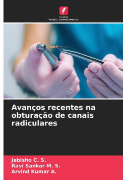 Avanços recentes na obturação de canais radiculares