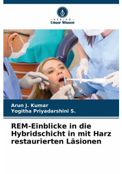 REM-Einblicke in die Hybridschicht in mit Harz restaurierten Läsionen