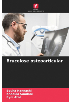 Brucelose osteoarticular