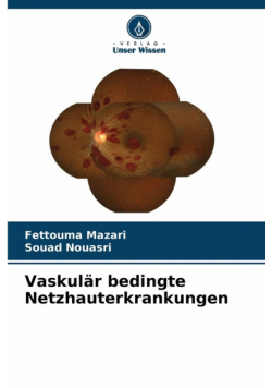 Vaskulär bedingte Netzhauterkrankungen