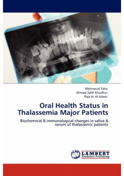 Oral Health Status in Thalassemia Major Patients