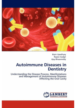 Autoimmune Diseases in Dentistry