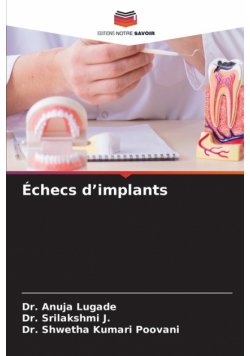 Échecs d'implants