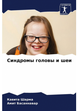 Cиндромы Головы И Шеи