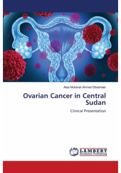 Ovarian Cancer in Central Sudan