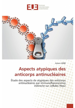 Aspects atypiques des anticorps antinucléaires