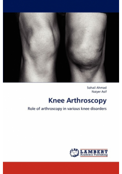 Knee Arthroscopy