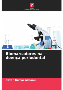 Biomarcadores na doença periodontal