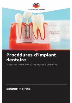 Procédures d'implant dentaire