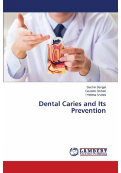 Dental Caries and Its Prevention