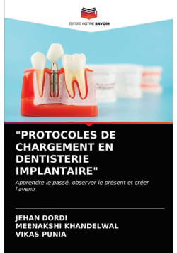 "protocoles De Chargement En Dentisterie Implantaire"