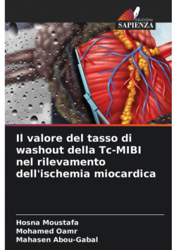 Il valore del tasso di washout della Tc-MIBI nel rilevamento dell'ischemia miocardica