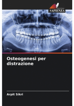 Osteogenesi per distrazione
