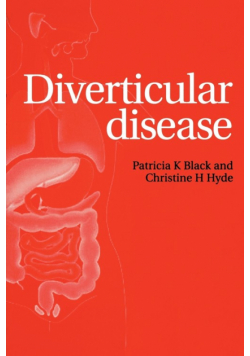Diverticular Disease