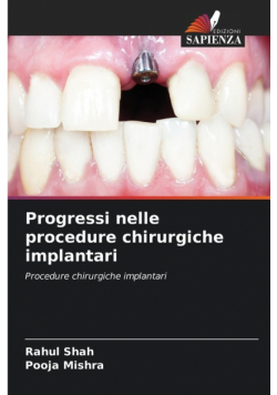 Progressi nelle procedure chirurgiche implantari