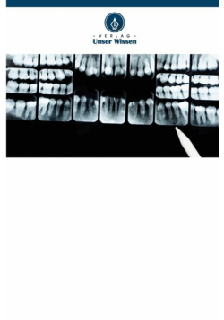 Wurzelresorption