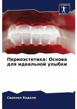 Периоэстетика