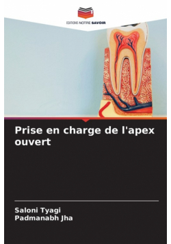 Prise en charge de l'apex ouvert
