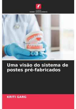 Uma visão do sistema de postes pré-fabricados
