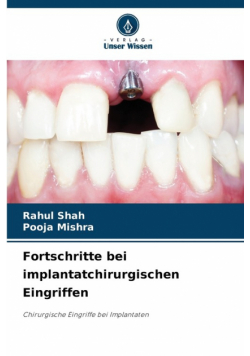 Fortschritte bei implantatchirurgischen Eingriffen