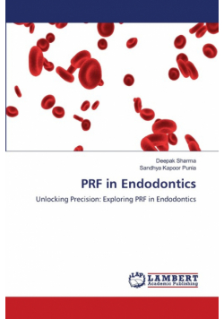 PRF in Endodontics