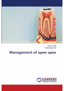 Management of open apex