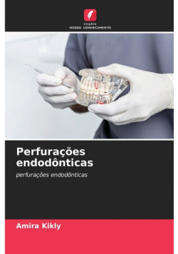 Perfurações endodônticas