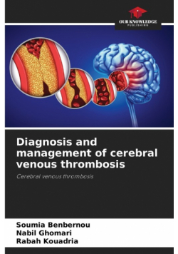Diagnosis and management of cerebral venous thrombosis