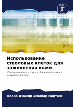 Использование стволовых клеток для заживления кожи