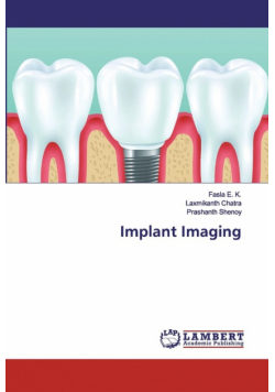 Implant Imaging