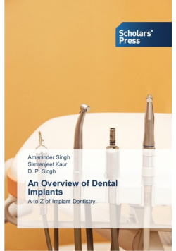 An Overview of Dental Implants