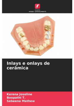 Inlays e onlays de cerâmica