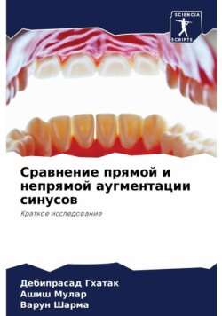 Сравнение прямой и непрямой аугментации синусов