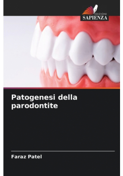 Patogenesi della parodontite