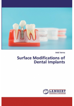Surface Modifications of Dental Implants