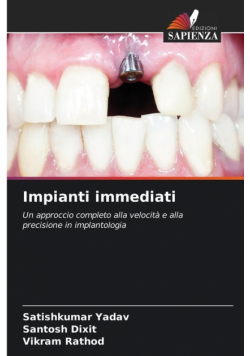 Impianti immediati