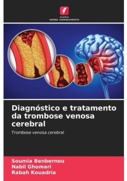 Diagnóstico e tratamento da trombose venosa cerebral