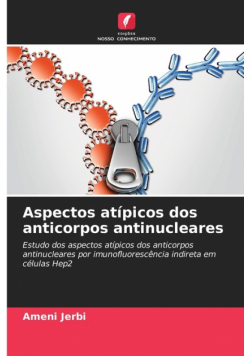 Aspectos atípicos dos anticorpos antinucleares