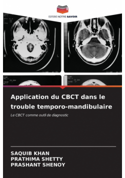 Application du CBCT dans le trouble temporo-mandibulaire