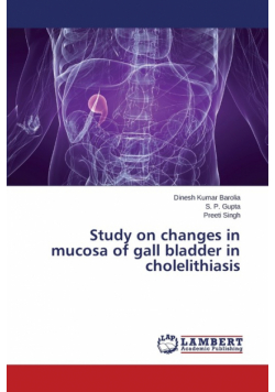 Study on Changes in Mucosa of Gall Bladder in Cholelithiasis