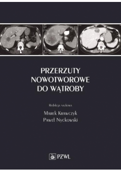 Przerzuty nowotworowe do wątroby