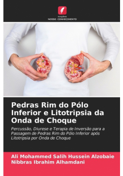 Pedras Rim do Pólo Inferior e Litotripsia da Onda de Choque