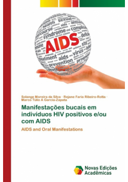 Manifestações bucais em indivíduos HIV positivos e/ou com AIDS