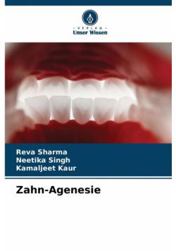 Zahn-Agenesie