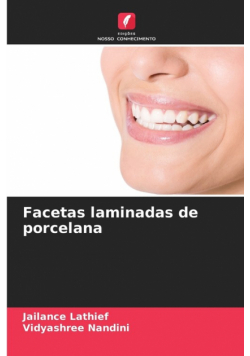 Facetas laminadas de porcelana