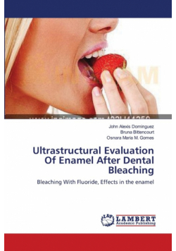 Ultrastructural Evaluation Of Enamel After Dental Bleaching